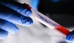corona-virus
